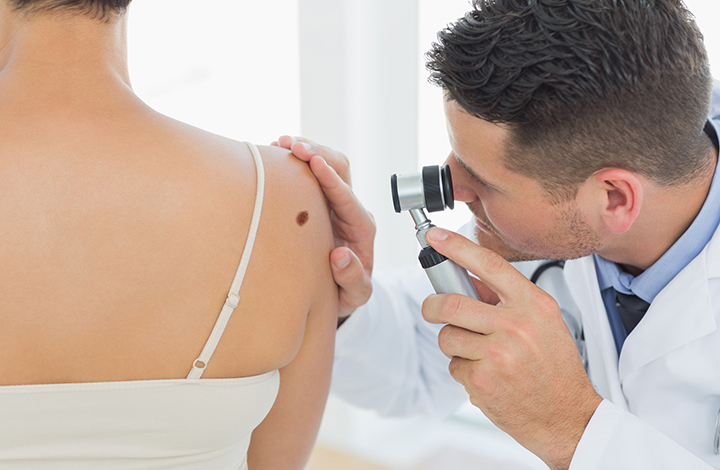 doctor examining mole on back of woman
